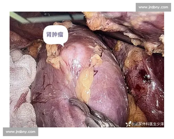 从肾癌病房到商业帝国:韦德如何用三重身份重塑人生 从肾癌病房到商业帝国:韦德如何用三重身份重塑人生